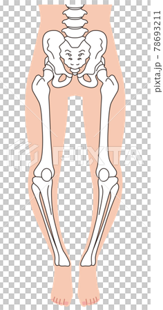 O型腿骨骼、骨盆扭曲、腿骨 78693211
