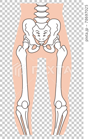O型腿骨骼、骨盆扭曲、腿骨 78697025