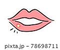 口唇ヘルペス　イラスト 78698711