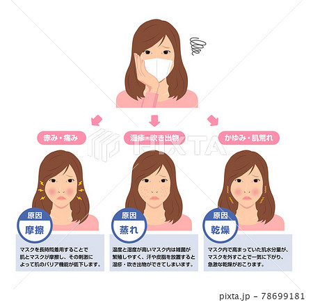 マスク着用による肌トラブルのイラスト / スキンケア (新型コロナウイルス) 78699181