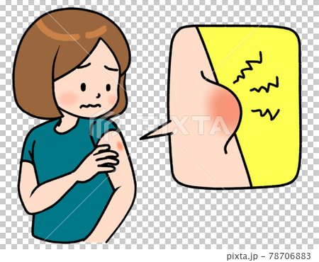 腕にできた虫刺されのようなできものを見る女の子のイラスト素材 腕にできた虫刺されのようなできものを見る女の子のイラスト素材