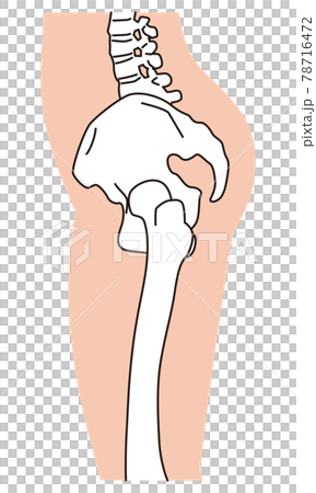 骨盆側視圖，O 型腿，骨盆扭曲 78716472