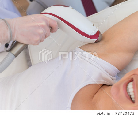 Doctor doing laser hair removal on a woman's armpit in the salon. An alternative way to permanently remove unwanted body hair 78720473
