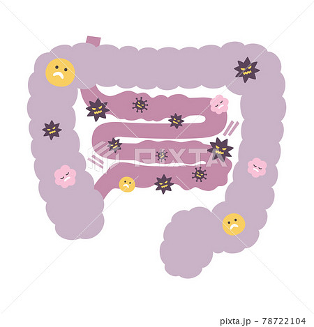 大腸より細菌が増えてしまった小腸のイラスト のイラスト素材