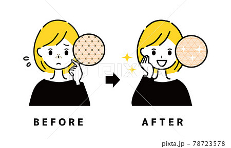 毛穴 鼻 ビフォーアフター 毛穴 鼻 ビフォーアフター 78723578