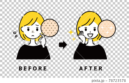 毛穴 鼻 ビフォーアフター 毛穴 鼻 ビフォーアフター 78723578