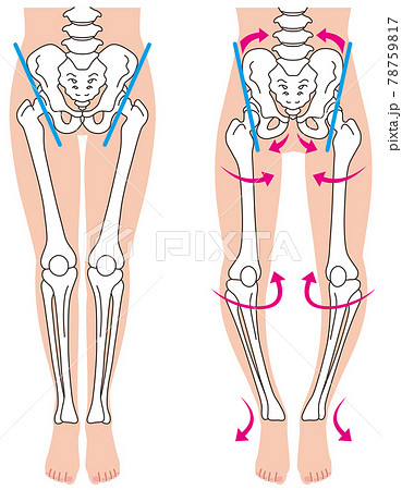 骨盤と骨格 O脚の骨格 骨盤の歪み 骨盤と骨格 O脚の骨格 骨盤の歪み 78759817