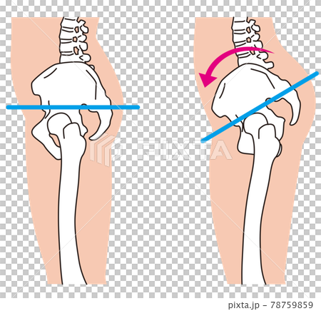 横から見た骨盤 O脚 骨盤の歪みのイラスト素材