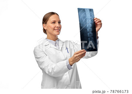 happy smiling female doctor with x-ray of spine happy smiling female doctor with x-ray of spine 78766173