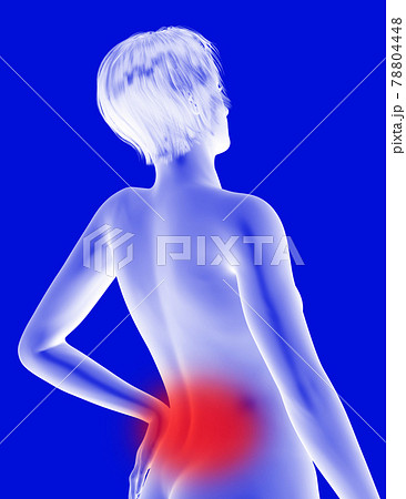 腰痛 腰痛 78804448