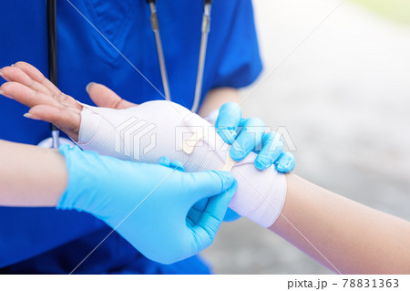Close-up of female doctor putting a bandage on injured hand upper limb of patient. Close-up of female doctor putting a bandage on injured hand upper limb of patient. 78831363