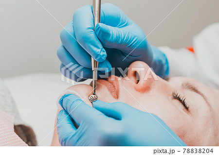 The beautician cleanses the patient's skin with a spoon uno, moisturizing, cleansing and skin care. 78838204