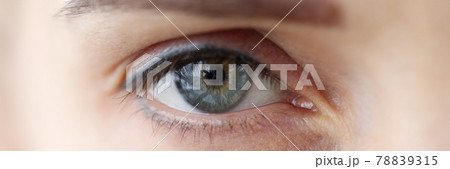 Womans eye with permanent eyelid and eyebrow makeup closeup 78839315