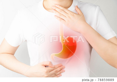 Gastroesophageal reflux disease (GERD) or acid reflux symptoms. Woman suffering from heartburn, stomachache, nausea and bloating. Gastrointestinal system disease and digestive problems. 78859889