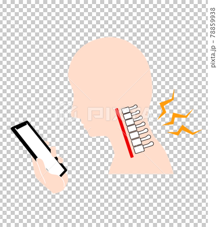 ストレートネック（スマホ首）　骨のイメージ 78859938