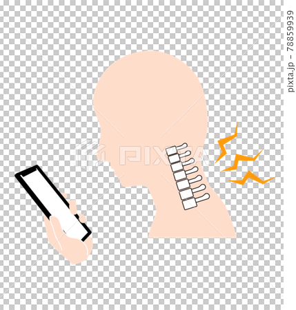 ストレートネック（スマホ首）　骨のイメージ 78859939