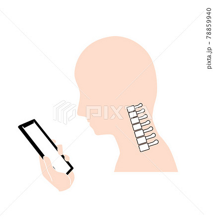 ストレートネック（スマホ首）　骨のイメージ 78859940