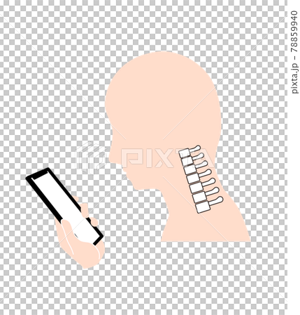 ストレートネック（スマホ首）　骨のイメージ 78859940