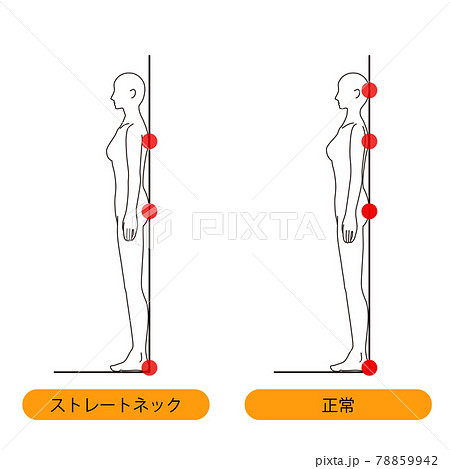 女性　メディカル　姿勢（ストレートネックチェック） 美容　裸　ヌード　全身　側面 78859942