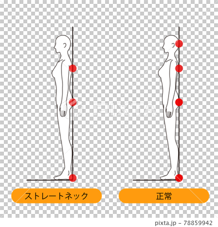 女性　メディカル　姿勢（ストレートネックチェック） 美容　裸　ヌード　全身　側面 78859942