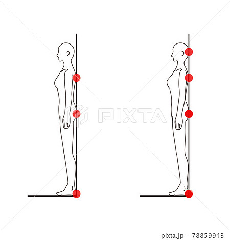 女性 メディカル 姿勢(ストレートネックチェック) 美容 裸 ヌード 全身 側面 女性 メディカル 姿勢(ストレートネックチェック) 美容 裸 ヌード 全身 側面 78859943