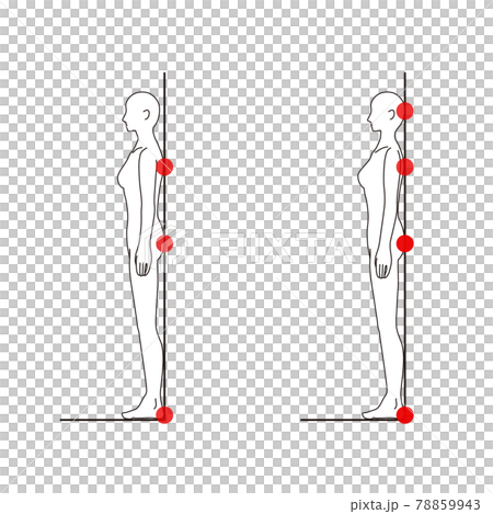 女性 メディカル 姿勢(ストレートネックチェック) 美容 裸 ヌード 全身 側面 女性 メディカル 姿勢(ストレートネックチェック) 美容 裸 ヌード 全身 側面 78859943