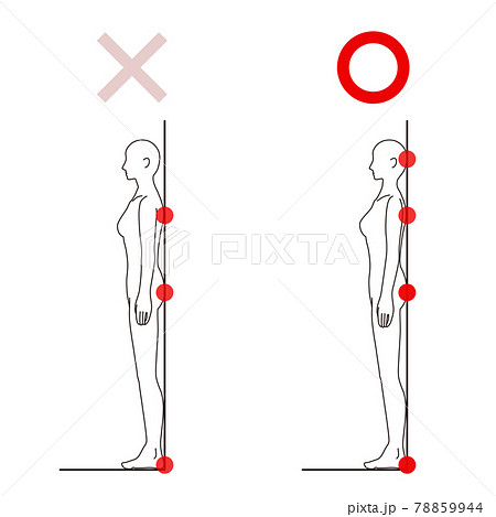 女性 メディカル 姿勢(ストレートネックチェック) 美容 裸 ヌード 全身 側面 女性 メディカル 姿勢(ストレートネックチェック) 美容 裸 ヌード 全身 側面 78859944