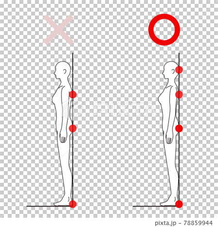 女性 メディカル 姿勢(ストレートネックチェック) 美容 裸 ヌード 全身 側面 女性 メディカル 姿勢(ストレートネックチェック) 美容 裸 ヌード 全身 側面 78859944