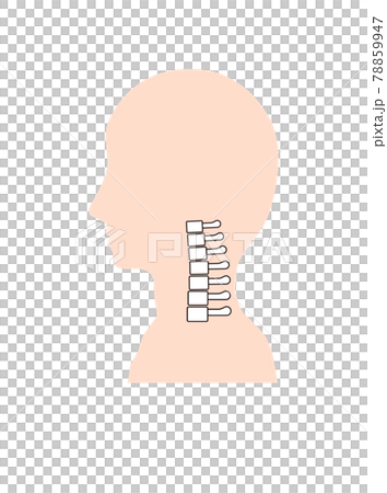 頸椎後湾症の首の骨のイメージ 78859947