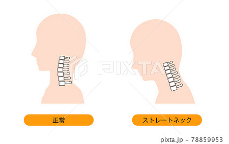 Straight neck smartphone neck, etc. - Stock Illustration [70813638