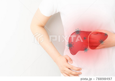 World hepatitis day concept. Woman suffering from abdominal pain with liver viral infection symbol. Awareness of prevention and treatment viral hepatitis that causes liver cancer. World hepatitis day concept. Woman suffering from abdominal pain with liver viral infection symbol. Awareness of prevention and treatment viral hepatitis that causes liver cancer. 78898497