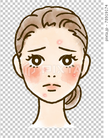 Face illustration of a woman suffering from white acne Face illustration of a woman suffering from white acne 78919174