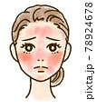 赤みに悩む女性の顔イラスト 78924678