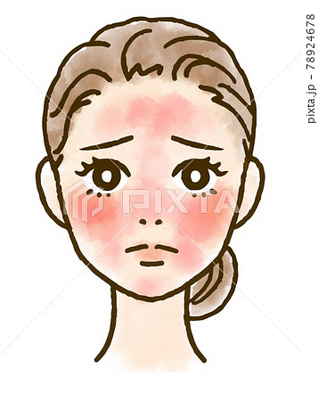 赤みに悩む女性の顔イラストのイラスト素材