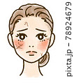 乾燥肌に悩む女性の顔イラスト 78924679