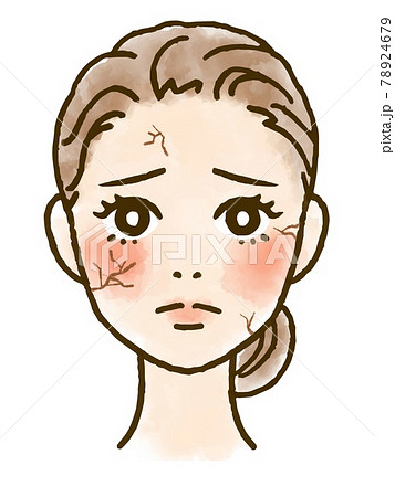 乾燥肌に悩む女性の顔イラストのイラスト素材