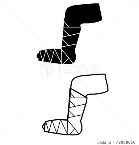 repaired bandaged leg icon on white background. broken leg sign.  injured foot in a cast bandage symbol. flat style. 78968650