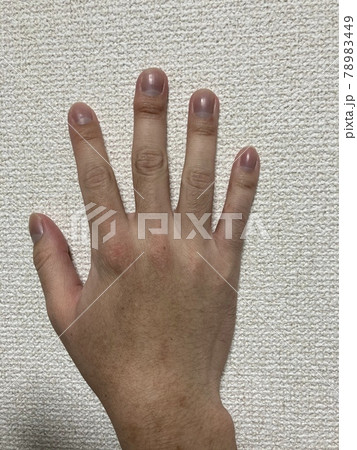 右手の手の甲と綺麗に磨いた爪 78983449