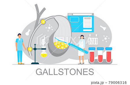 Gallbladder concept vector. Doctors treat gallstones. Web, landing page Gallbladder concept vector. Doctors treat gallstones. Web, landing page 79006316