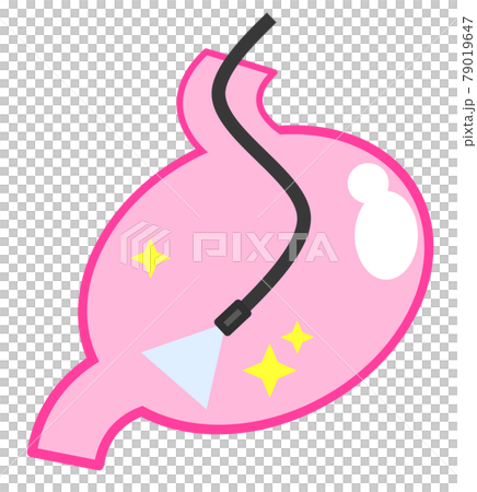 Illustration of performing a detailed examination using a gastrocamera in a health examination 79019647