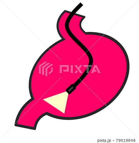 健康診断で胃カメラを使用して精密検査をするイラスト 79019648