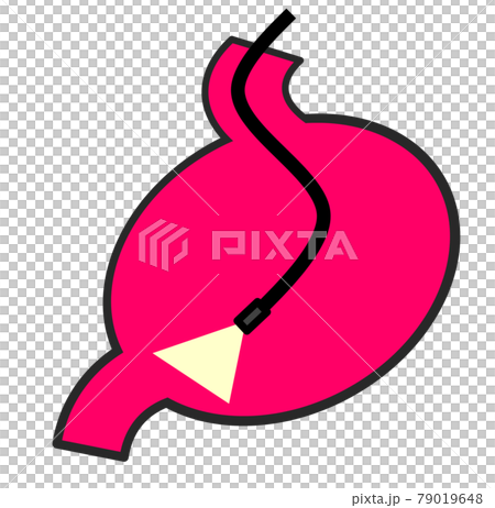 Illustration of performing a detailed examination using a gastrocamera in a health examination 79019648