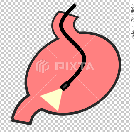 Illustration of performing a detailed examination using a gastrocamera in a health examination 79019649