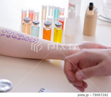 Doctor testing allergy reaction of patient in hospital Doctor testing allergy reaction of patient in hospital 79067282