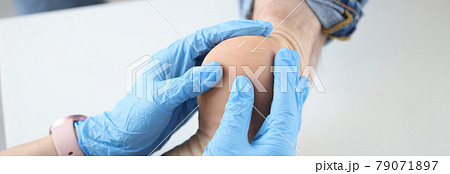 Doctor dermatologist in gloves examining patients heel closeup 79071897