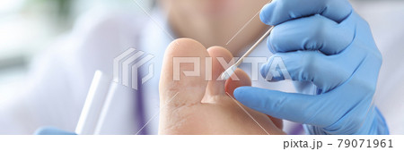 Doctor treating patients toes in clinic closeup Doctor treating patients toes in clinic closeup 79071961
