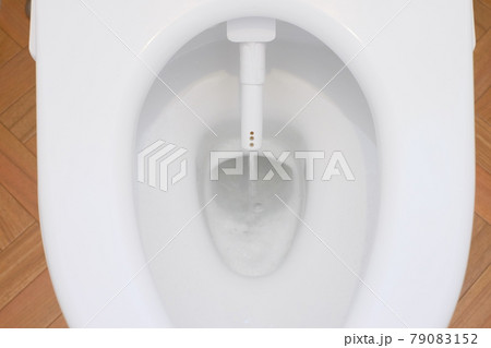 トイレのノズル ウォシュレットのノズル トイレのノズル ウォシュレットのノズル 79083152