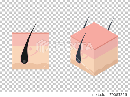 Illustration material of hair root, pore, scalp 79085226