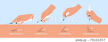 Types injections. Guide to injecting vaccines into skin. Hands holds syringes at different angles. Doctors arms vaccinate patients. Vector medical procedure manuals for hospital workers Types injections. Guide to injecting vaccines into skin. Hands holds syringes at different angles. Doctors arms vaccinate patients. Vector medical procedure manuals for hospital workers 79101057