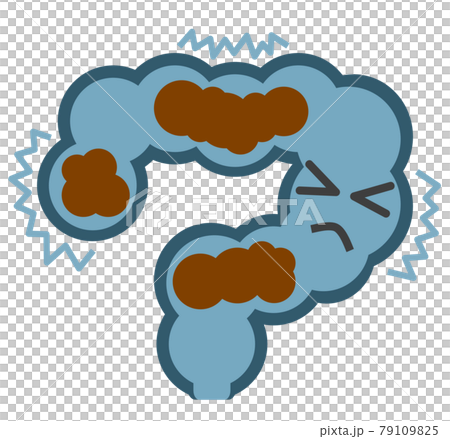 便秘でお腹が痛くなる大腸のイラスト 79109825